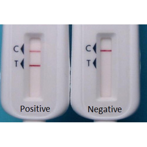 [CHE TÊN] Que Test xét nghiệm Hiv Bằng Dịch Miệng, Que Thử Hiv Oraquick không cần lấy máu