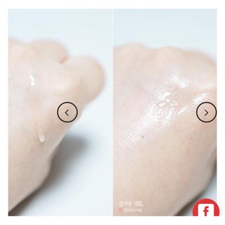 Tế bào gốc phức hợp ELRAVIE