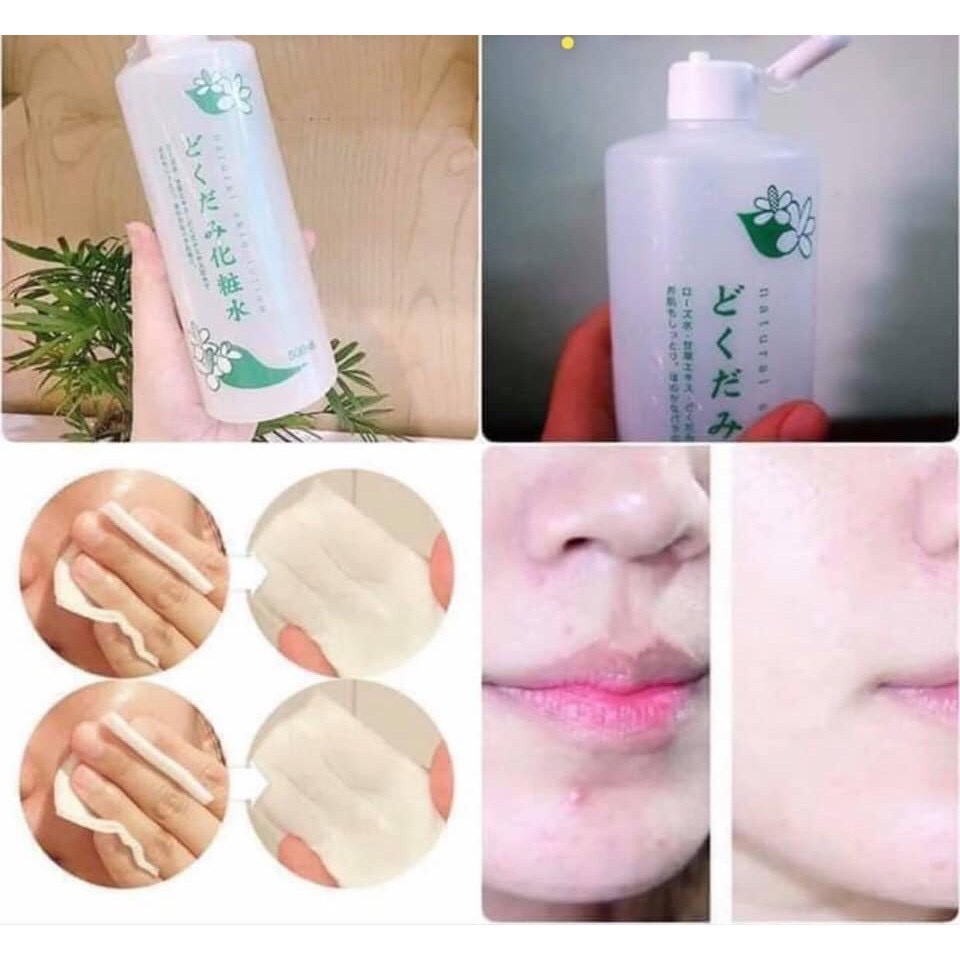 Nước hoa hồng lotion toner diếp cá, tía tô giảm mụn Dokudami Nhật Bản