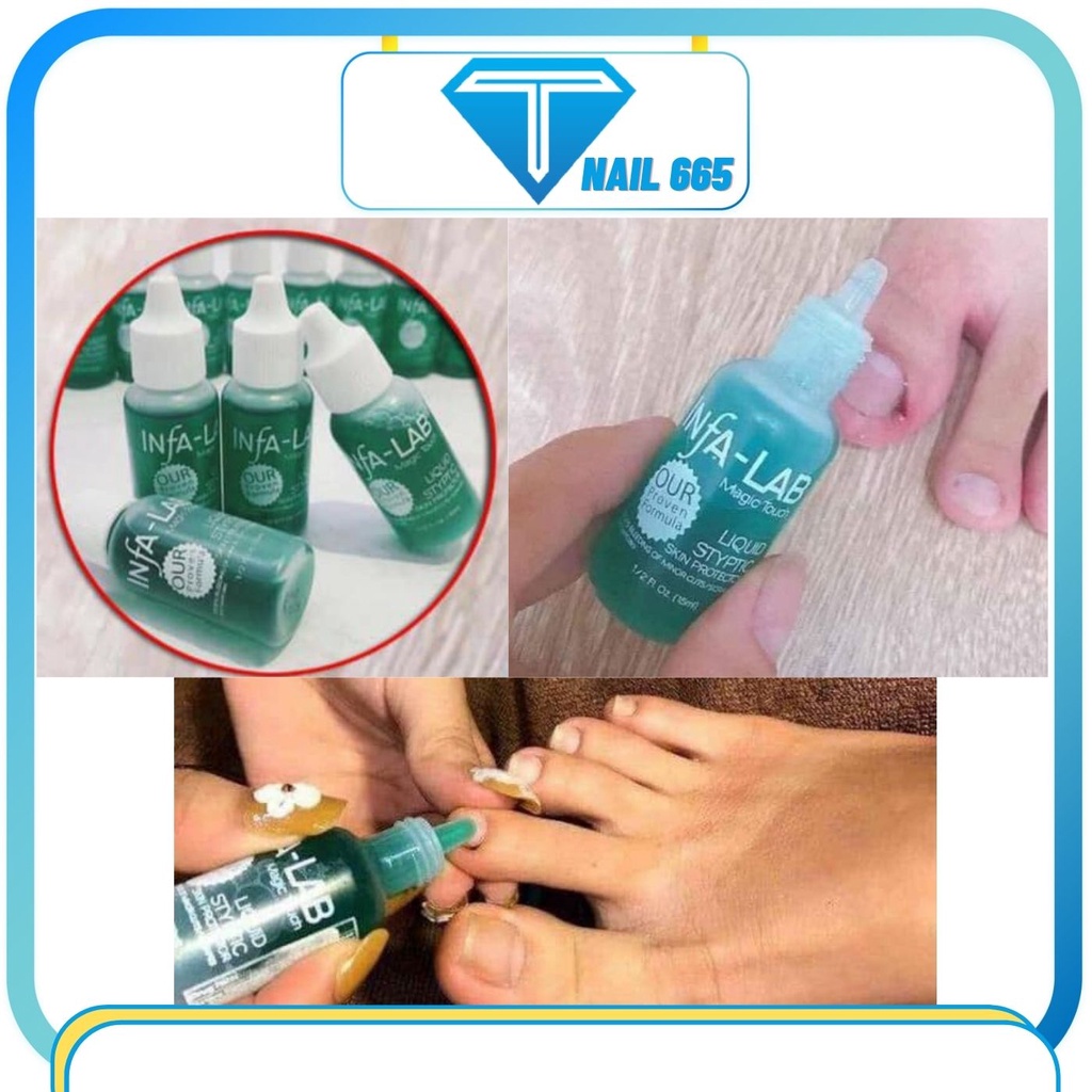 Dung dịch cầm máu INFA-LAB lọ 15ml , Cầm máu móng nail khi nhặt da lấy khóe tay chân