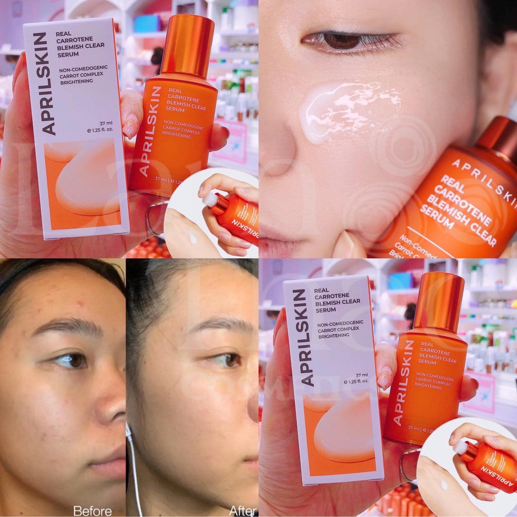 Tinh Chất Aprilkin Real Carrotene Blemish Clear Serum 37ML