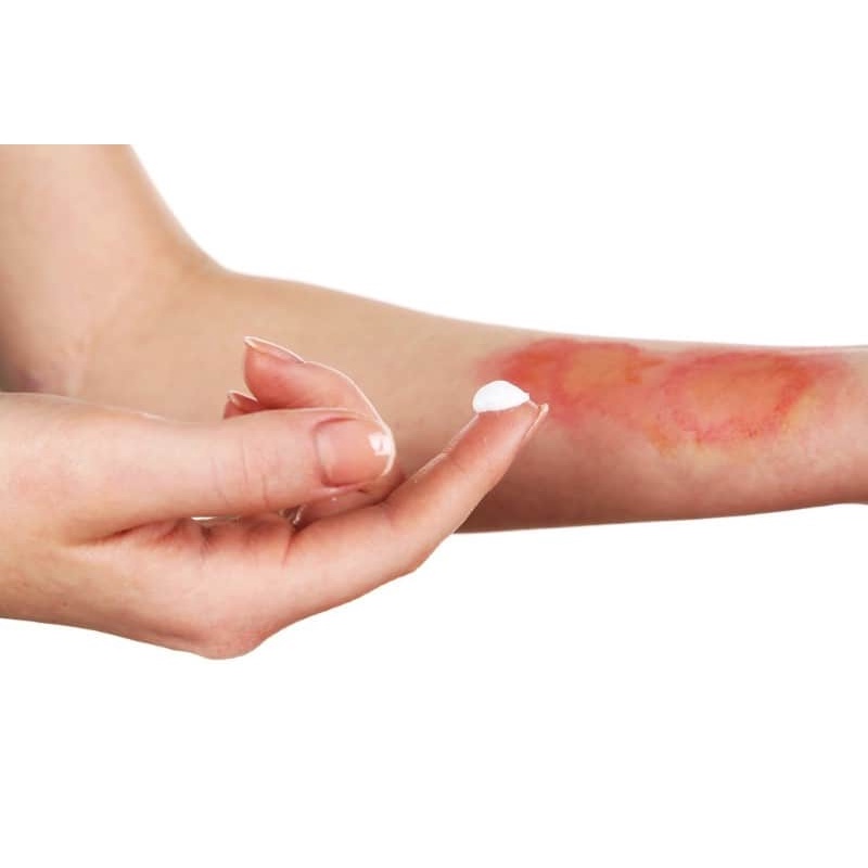 Kem trị bỏng Nga - Kem bôi vết bỏng Nga Evo Panthenol