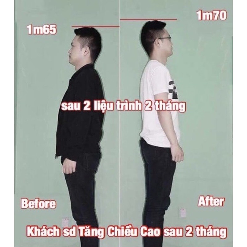 Tinh chất tăng chiều cao Miracle - Pháp, hiệu quả chỉ sau 1 tháng (30ml)