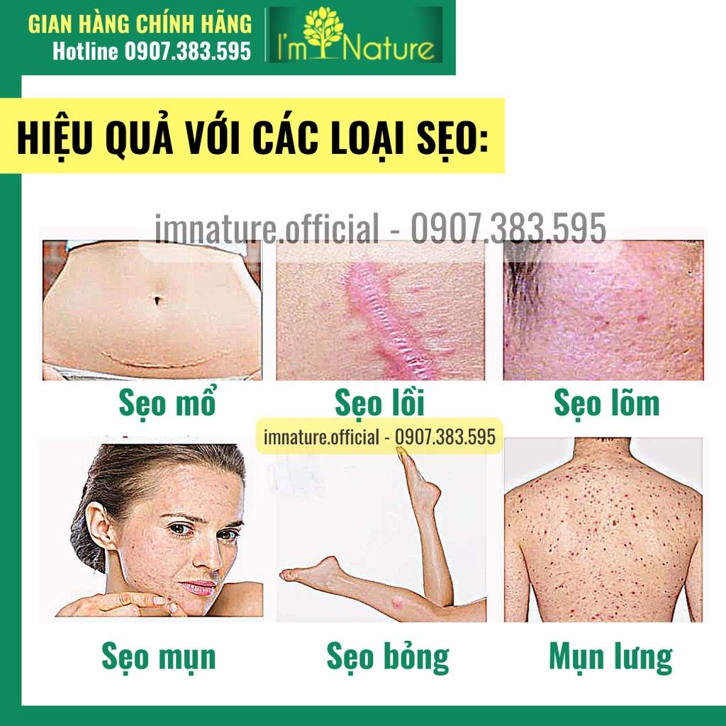 Kem Sẹo Peimei - Giảm Sẹo Và Rạn Da Hiệu Quả Sau 1 Tuần 30gr