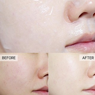 Mặt Nạ Mediheal Essential Mask EX