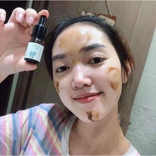 Serum Chữa Mụn LUMOS ACNE..