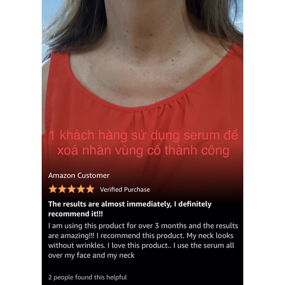 Tinh chất HA cấp ẩm, thu nhỏ lỗ chân lông lành tính SenAllis