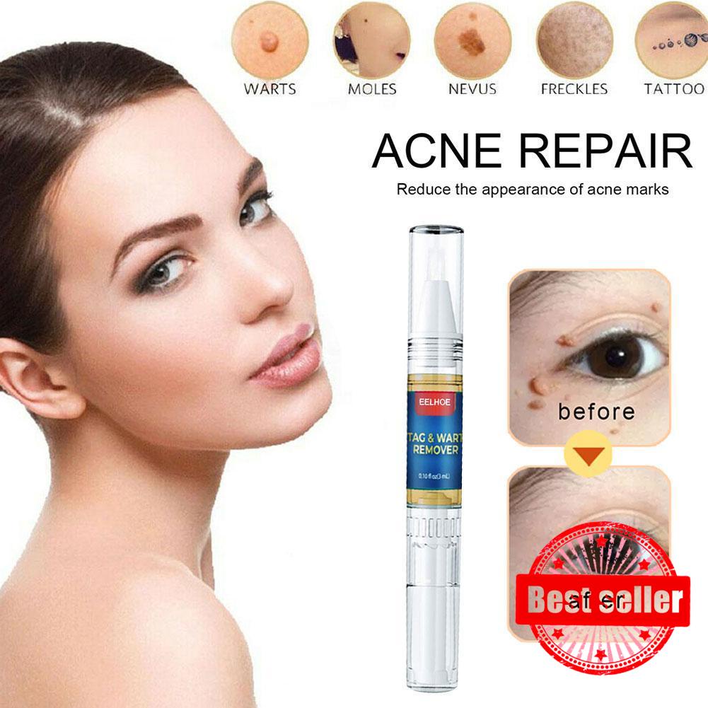 Bút Tẩy Nốt Ruồi Làm Mịn Da F2U0