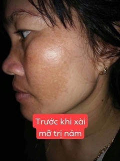 Mỡ trăn N’store 5k