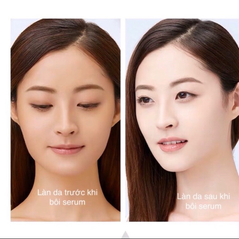 LUCENBASE Tinh Chất Dưỡng Trắng Da Chuyên Dụng