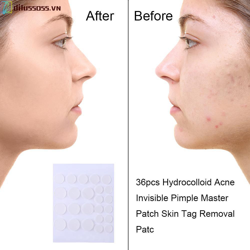 Bộ 24/36 miếng dán Hydrocolloid hỗ trợ loại bỏ mụn thoáng khí chăm sóc da mặt