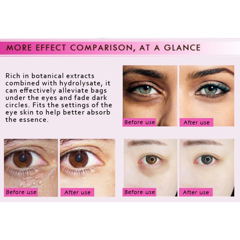 RtopR Mặt nạ mắt chứa vitamin C trị quầng thâm bọng mắt ngăn ngừa nếp nhăn và lão hóa