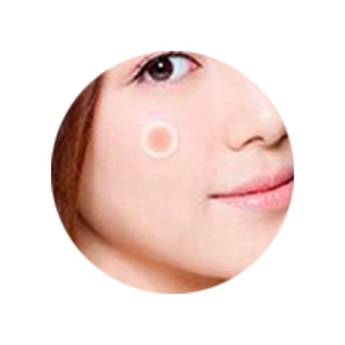 Miếng dán sẹo mụn thành phần mật ong che khuyết điểm chăm sóc da