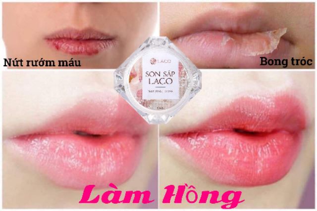 [ Rẻ vô địch ] SON SÁP LACO DƯỠNG HỒNG VÀ CHỐNG THÂM MÔI | BigBuy360 - bigbuy360.vn