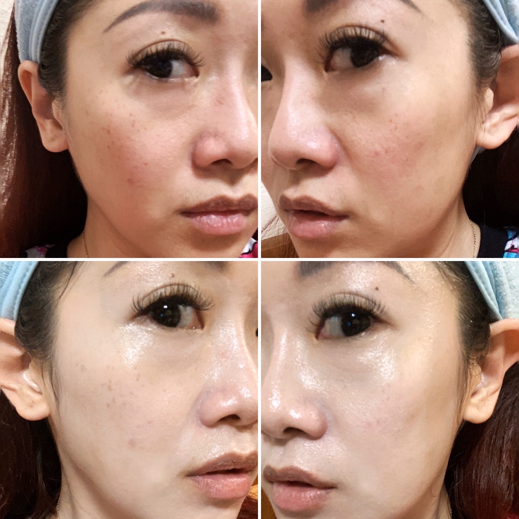 Bộ dưỡng trắng da rạng rỡ chiết xuất hoa anh đào Innisfree Jeju Cherry Blossom Dou Kit