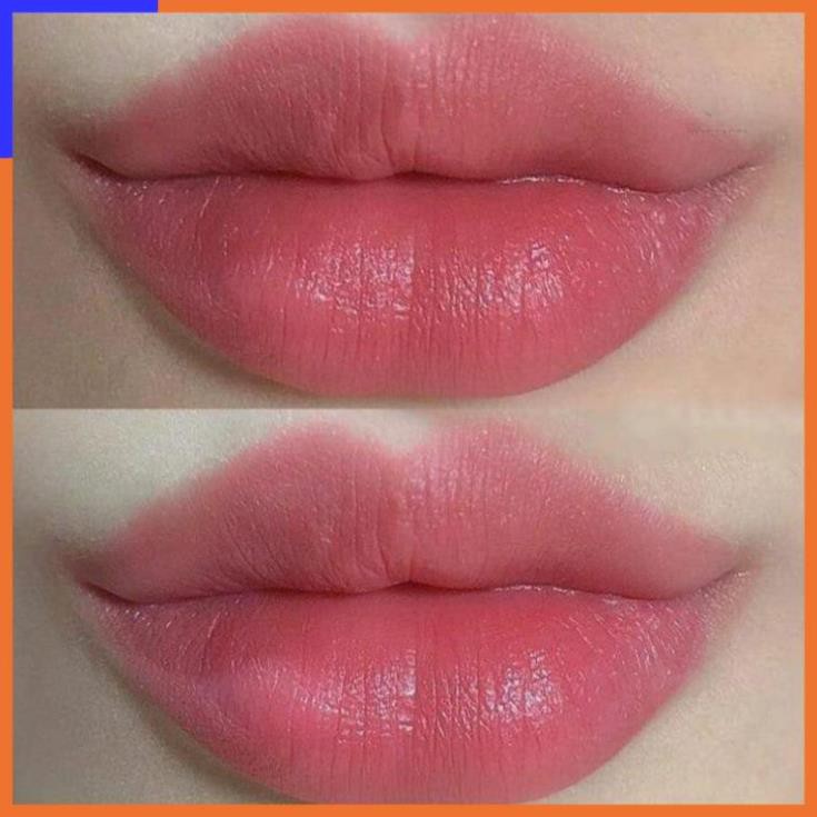 SON Ủ MÔI SHI - MỀN MÔI -DƯỠNG MÔI - HỒNG MÔI - TRỊ THÂM MÔI V V V | Thế Giới Skin Care