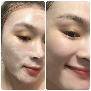 1 lọ cấy phấn Meso white