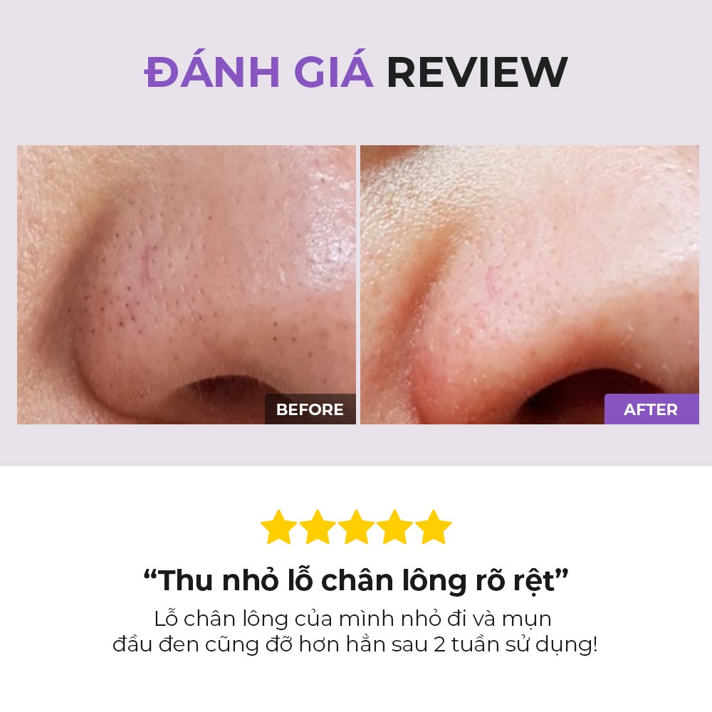 Nước cân bằng COSRX BHA hỗ trợ làm giảm mụn đầu đen dung tích 50ml/ 100ml | BigBuy360 - bigbuy360.vn