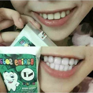 ( GIÁ SỈ ) Baking soda bột trắng răng chac