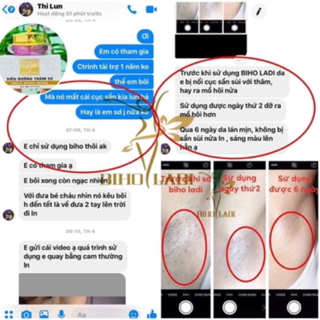 BIHO LADI kem đặc trị thâm hôi (nách, bẹn, Mông, bikini) | BigBuy360 - bigbuy360.vn