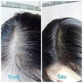 Dầu gội bồ kết