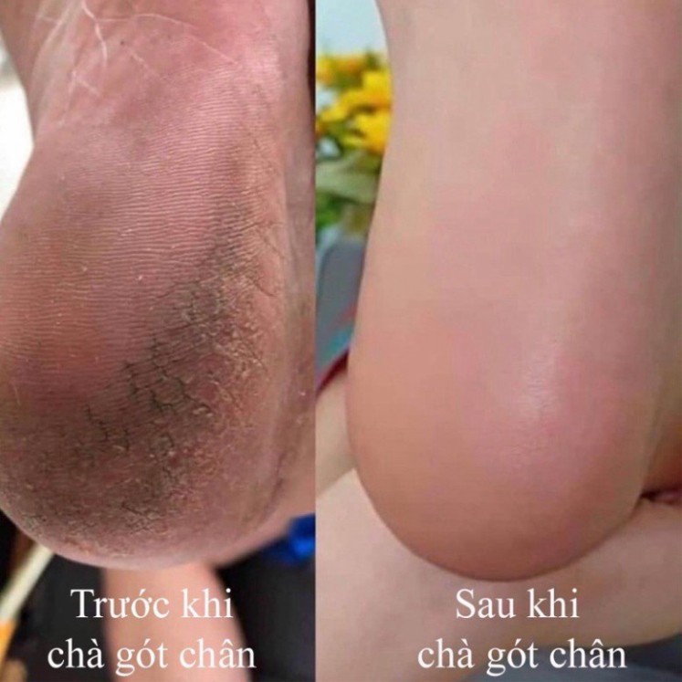 Mặt lưỡi chà gót chân thay thế - dụng cụ chà gót chân inox 304 chuyên dụng cho dân làm móng V9