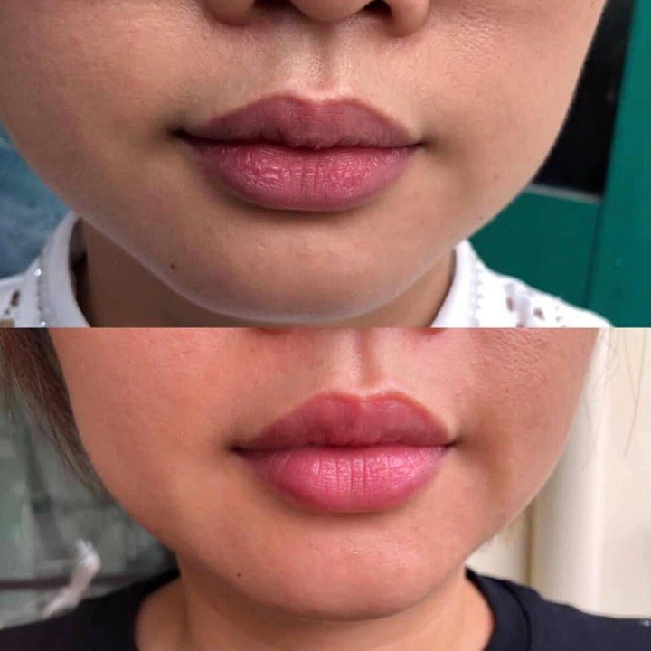 [HÀNG CHÍNH HÃNG ] Cây trị thâm  Tavida | BigBuy360 - bigbuy360.vn