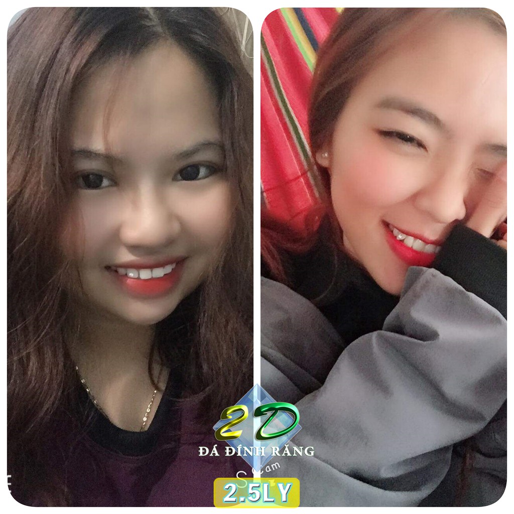 Đá dán răng CAO CẤP loại đế bằng đính tại nhà hộp 3 viên đủ size + keo dán