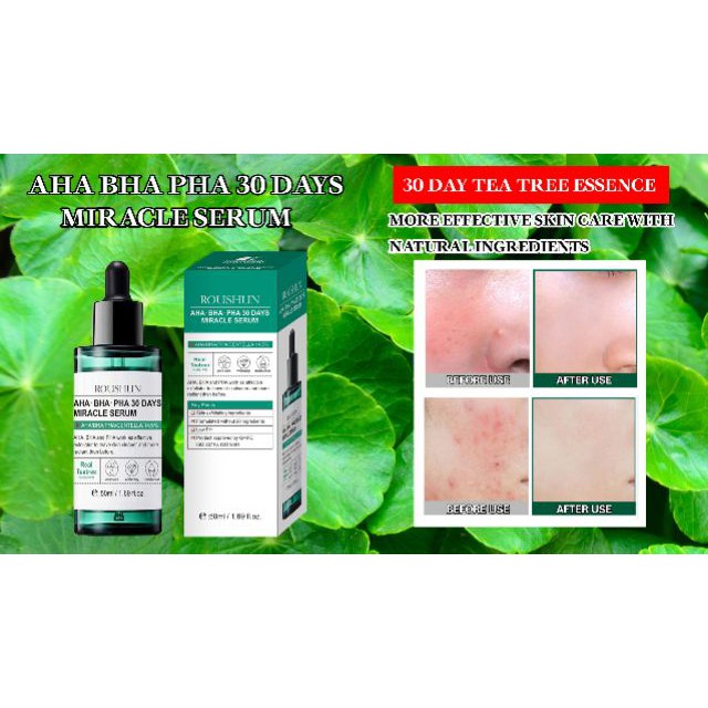 Serum AHA-BHA-PHA 30 Days Miracle Serum 50ml
