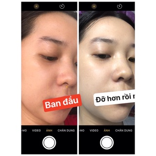KEM FACE CREAM ( Dưỡng da ban đêm)