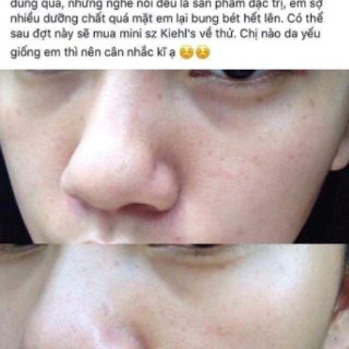 Serum caudalie sáng da