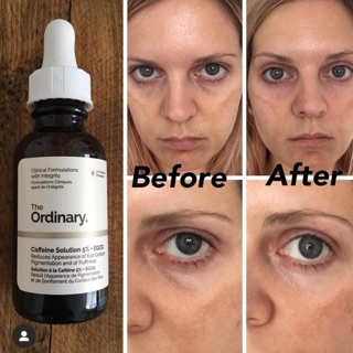 Serum dưỡng mắt The Ordinary Caffein Solution 5% + EGCG
