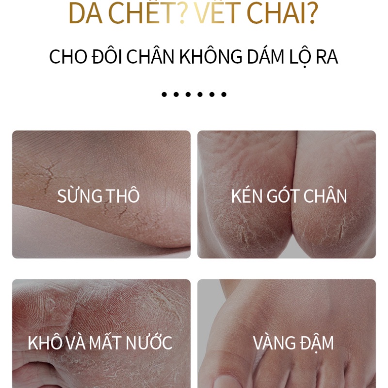 [HCM]Hàng mới về Mạt nạ chân tẩy da chết tiện lợi 1 cái -URBZM