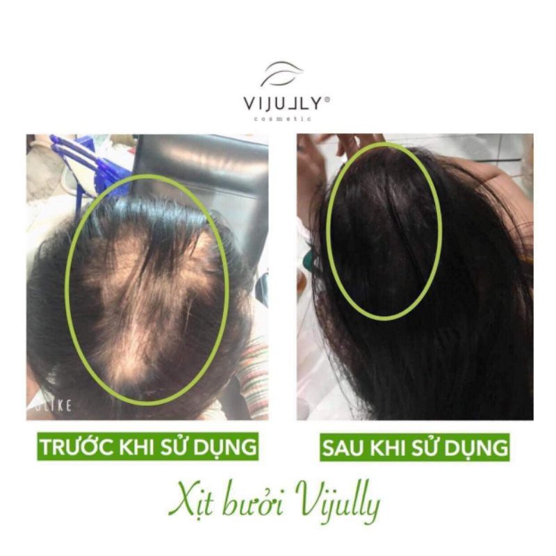 Tinh dầu bưởi kichmoctoc | BigBuy360 - bigbuy360.vn