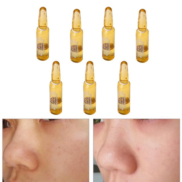 Serum Dưỡng da martiderm The Originals Proteos Liposome Sáng Đều Màu Da, Giảm Đốm Sắc Tố Và Bã Nhờn