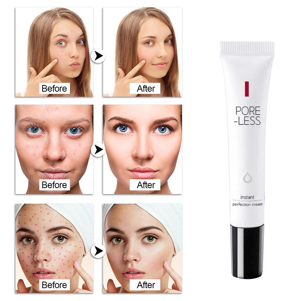 [Hàng mới về] Kem Dưỡng B8C1 Làm Đẹp Da Hoàn Hảo 20g | BigBuy360 - bigbuy360.vn