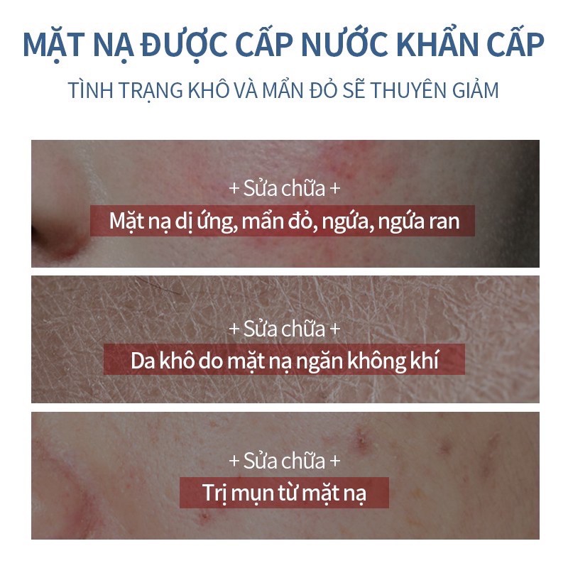 ( HÀNG CÓ SẴN ) Combo 5 Miếng nạ Dành Cho Da Nhạy Cảm Mẹ Bầu Có Thể Sử Dụng 25ml