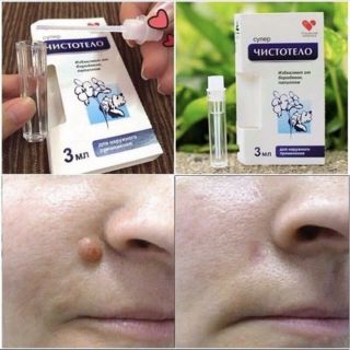 GEL TẨY NỐT RUỒI LỒI, MỤN THỊT, MỤN CƠM VÀ SẸO LỒI, THỊT THỪA DVELINIL