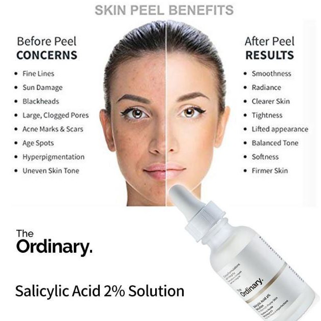 The Ordinary Salicylic Acid 2% Solution ( Serum Chống Mụn) | BigBuy360 - bigbuy360.vn
