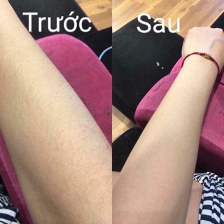Máy Cạo Lông Kemei