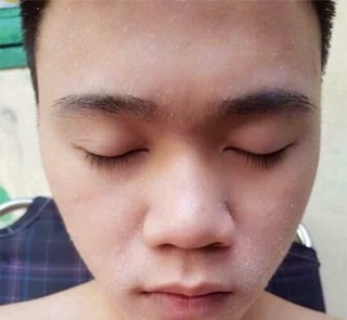 Combo 1: thuốc+ bột rửa mặt + bột mặt nạ