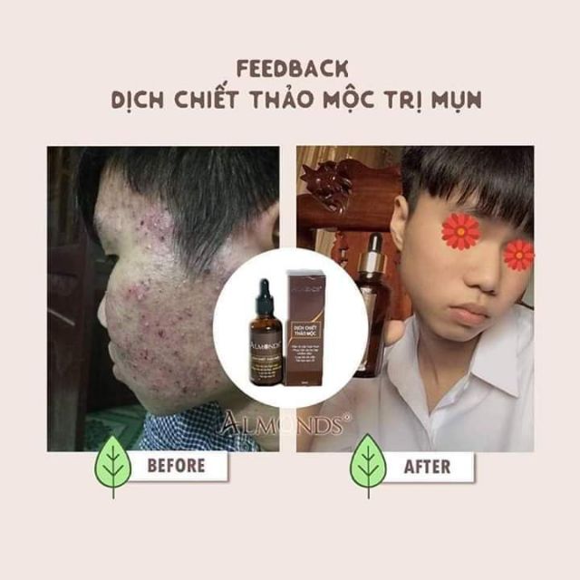 DỊCH CHIẾT THẢO MỘC ALMONDS