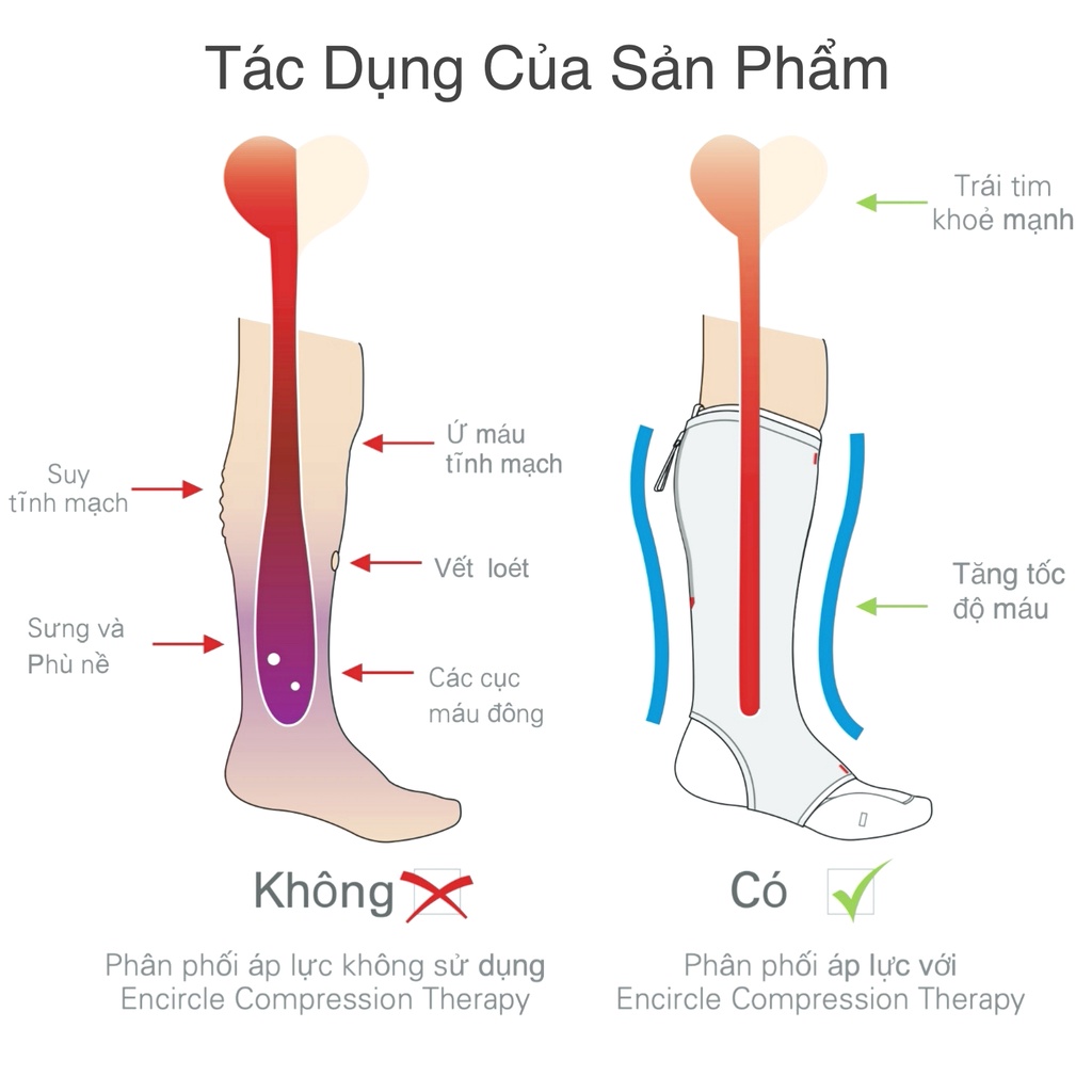 Vớ suy giãn tĩnh mạch Vớ y khoa hỗ trợ cho người bị giãn tĩnh mạch bắp chân (1 hộp 1 chân) | BigBuy360 - bigbuy360.vn