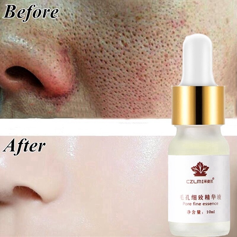 Serum Hyaluronic Acid Se Khít Lỗ Chân Lông Chống Lão Hóa Da 10ml