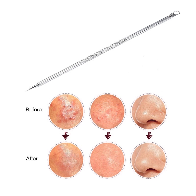 Bộ Dụng Cụ Loại Bỏ Mụn Đầu Đen Bằng Thép Không Gỉ
