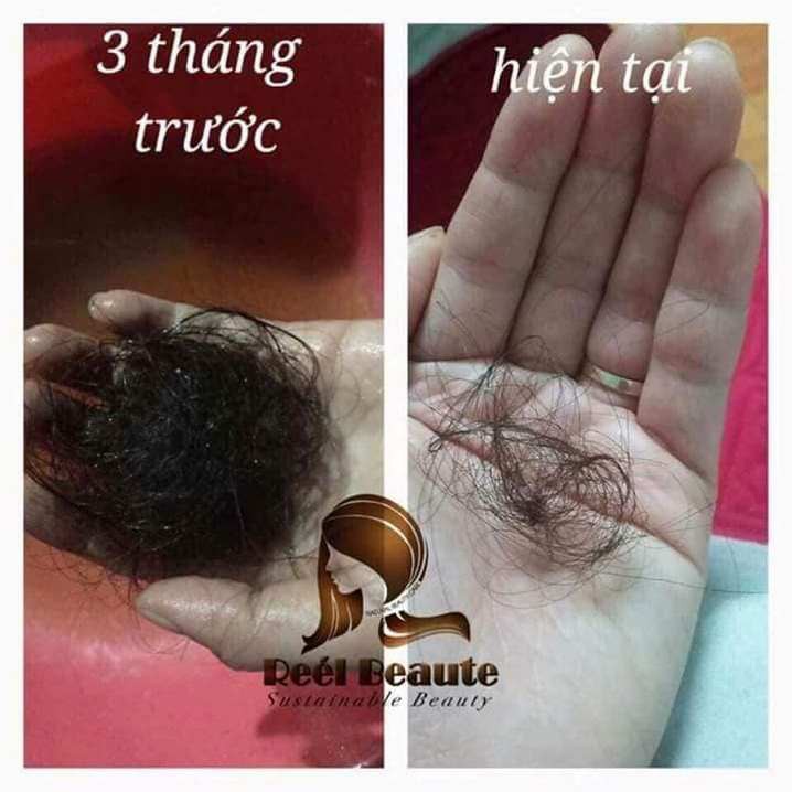 COMBO 05 hộp túi lọc DÒNG CAO CẤP gội đầu thiên nhiên reel breaute