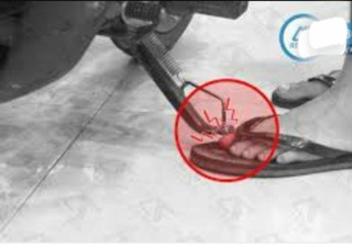 Bọc chân chống xe máy