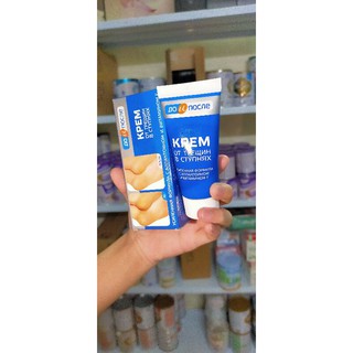 Kem trị nứt gót chân
