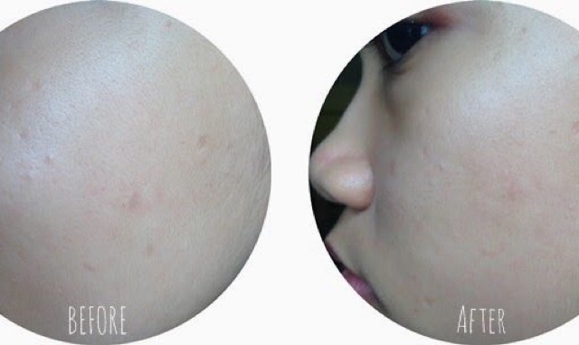 Serum Hỗ Trợ Giảm thâm Kiehl’s Dark Spot Solution 4ml | BigBuy360 - bigbuy360.vn