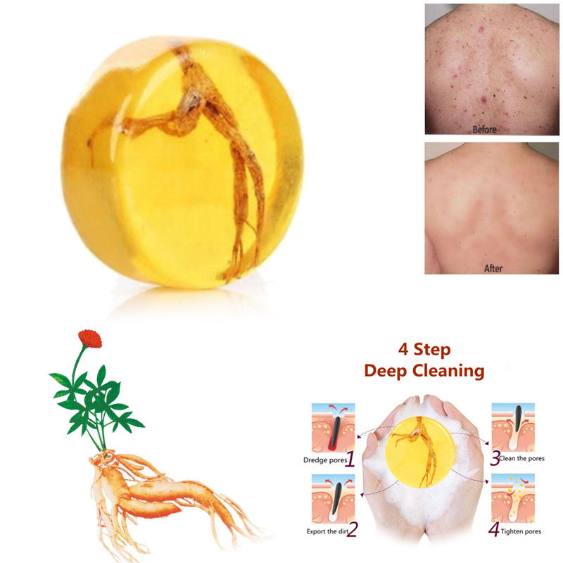 Xà Phòng Tinh Chất Nhân Sâm Thủ Công Dưỡng Ẩm Làm Sạch Sâu Hỗ trợ giảm mụn Trứng Cá Và Làm Trắng Da